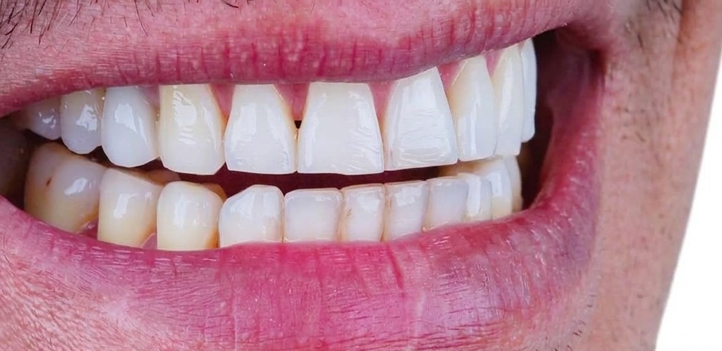 Dental · smile makeover, before